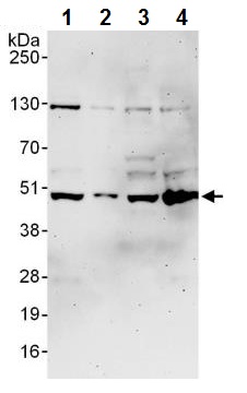 Western blot - Anti-Protein Kinase A regulatory subunit I alpha/PRKAR1A antibody (AB245465), expandable thumbnail