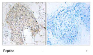 Immunohistochemistry (Formalin/PFA-fixed paraffin-embedded sections) - Anti-Protein phosphatase 1 inhibitor subunit 2 antibody (AB73948)