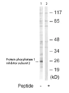 Western blot - Anti-Protein phosphatase 1 inhibitor subunit 2 antibody (AB73948)