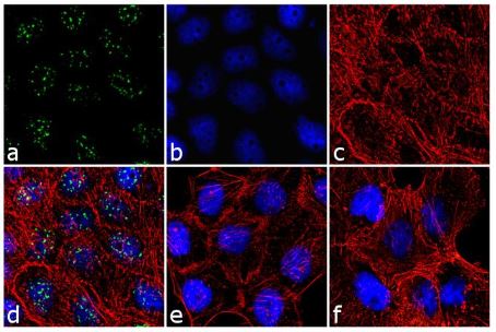 Immunocytochemistry/ Immunofluorescence - Anti-Protein phosphatase 1 inhibitor subunit 2 (phospho T72) antibody (AB27850), expandable thumbnail