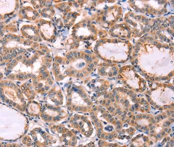 Immunohistochemistry (Formalin/PFA-fixed paraffin-embedded sections) - Anti-Protein S antibody (AB197825)