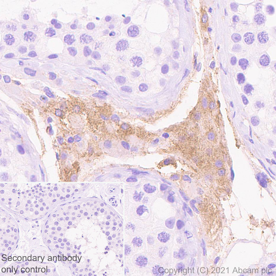 Immunohistochemistry (Formalin/PFA-fixed paraffin-embedded sections) - Anti-Protein S antibody [EPR24509-70] (AB280885), expandable thumbnail