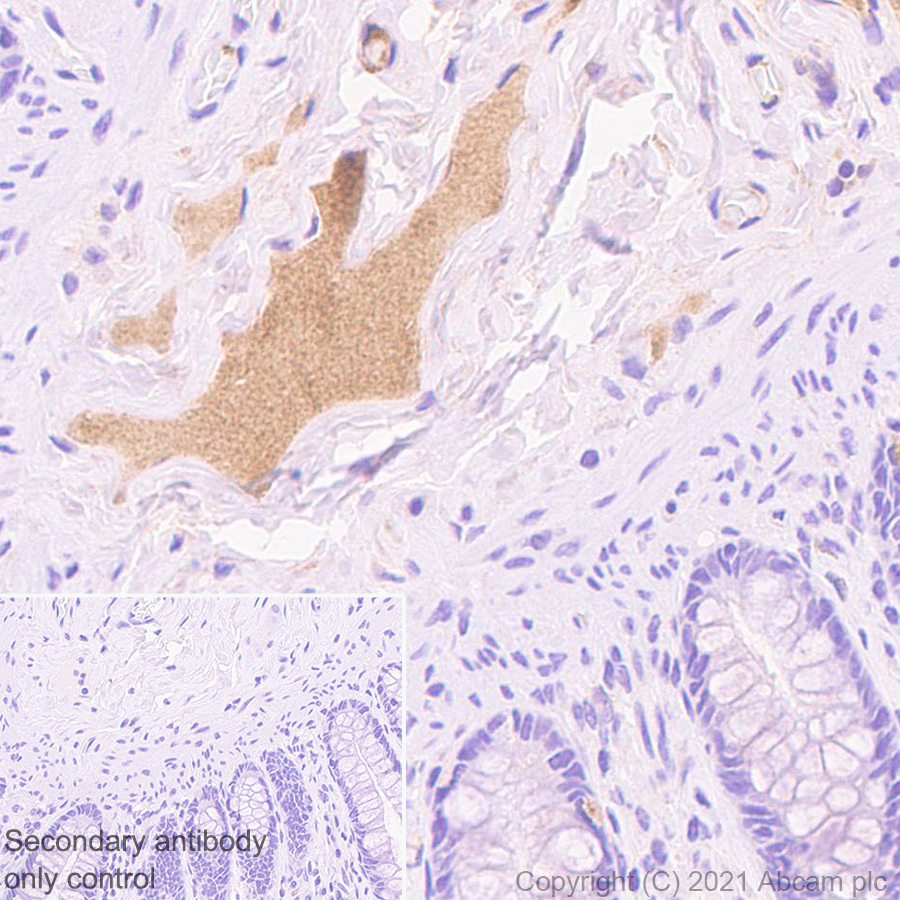 Immunohistochemistry (Formalin/PFA-fixed paraffin-embedded sections) - Anti-Protein S antibody [EPR24509-70] (AB280885), expandable thumbnail