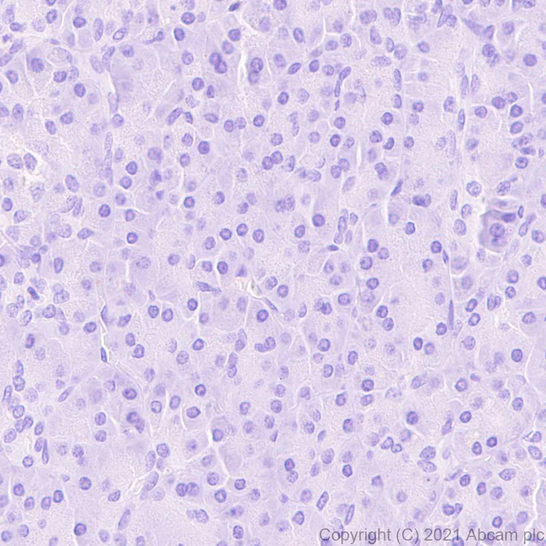 Immunohistochemistry (Formalin/PFA-fixed paraffin-embedded sections) - Anti-Protein S antibody [EPR24509-70] (AB280885)