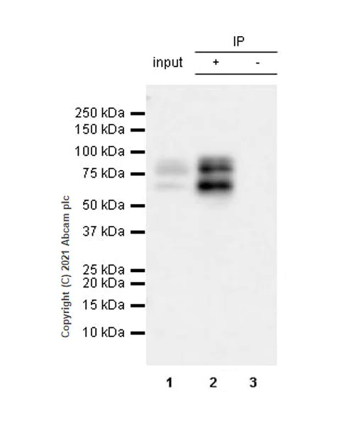 Immunoprecipitation - Anti-Protein S antibody [EPR24509-70] (AB280885)