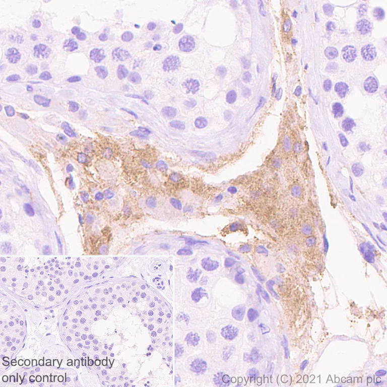 Immunohistochemistry (Formalin/PFA-fixed paraffin-embedded sections) - Anti-Protein S antibody [EPR24509-70] - BSA and Azide free (AB280894)