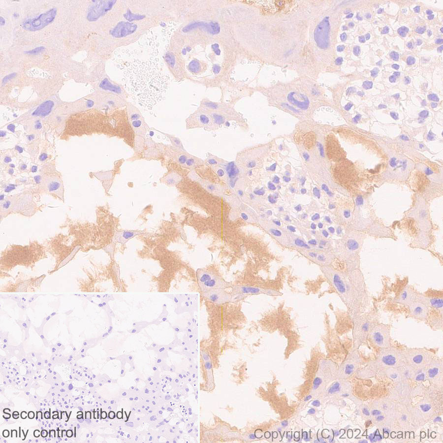 Immunohistochemistry (Formalin/PFA-fixed paraffin-embedded sections) - Anti-Protein S antibody [EPR28196-36] (ab316281), expandable thumbnail