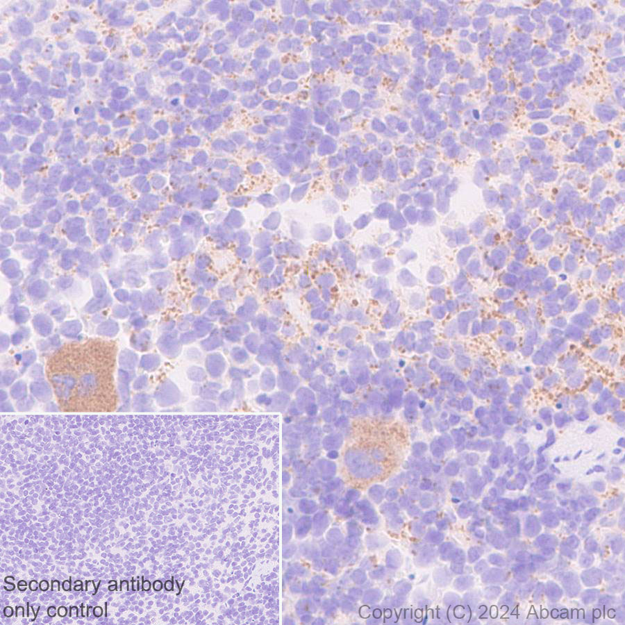 Immunohistochemistry (Formalin/PFA-fixed paraffin-embedded sections) - Anti-Protein S antibody [EPR28196-36] (ab316281), expandable thumbnail