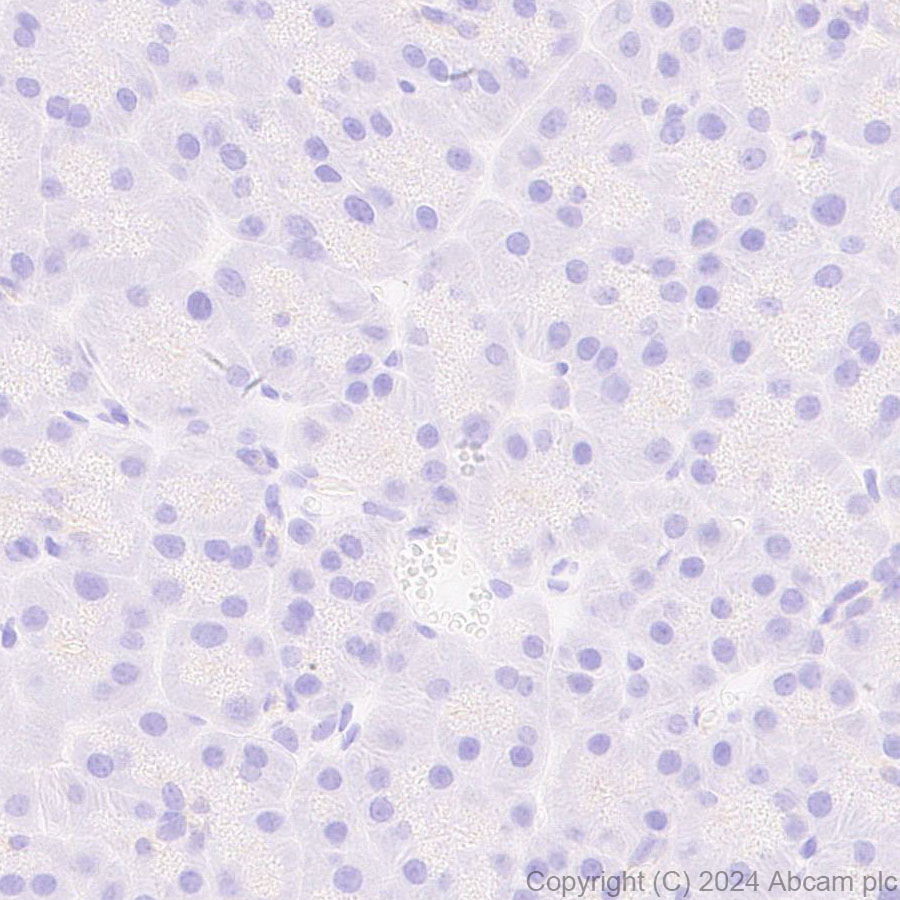 Immunohistochemistry (Formalin/PFA-fixed paraffin-embedded sections) - Anti-Protein S antibody [EPR28196-36] (AB316281), expandable thumbnail