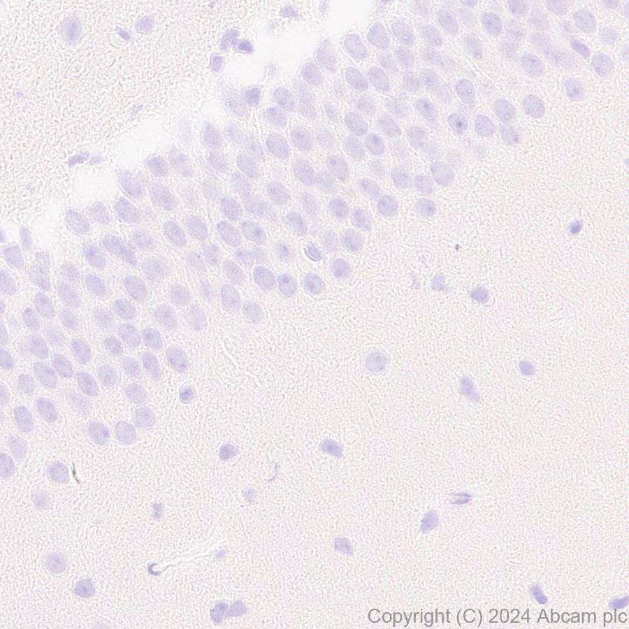 Immunohistochemistry (Formalin/PFA-fixed paraffin-embedded sections) - Anti-Protein S antibody [EPR28196-36] (AB316281), expandable thumbnail