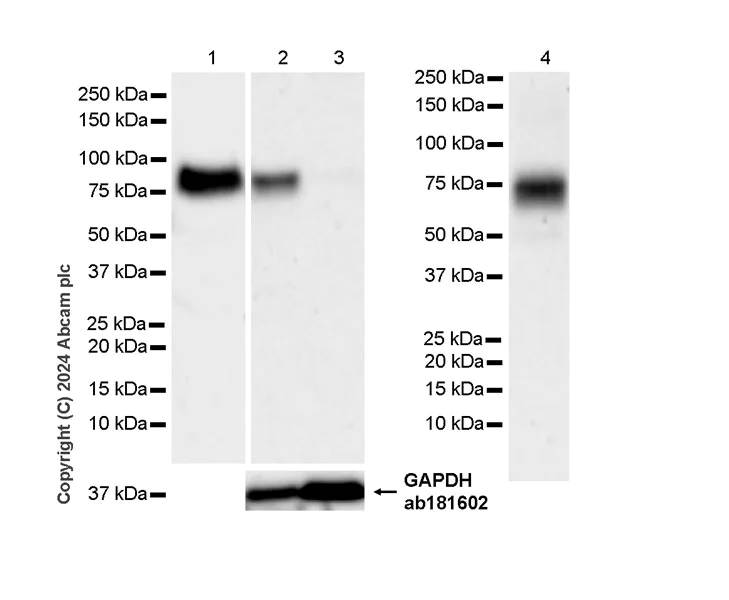 Western blot - Anti-Protein S antibody [EPR28196-36] (AB316281)
