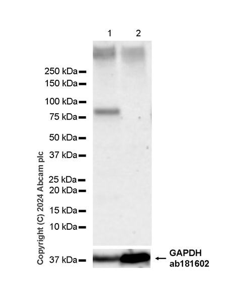 Western blot - Anti-Protein S antibody [EPR28196-36] (AB316281), expandable thumbnail
