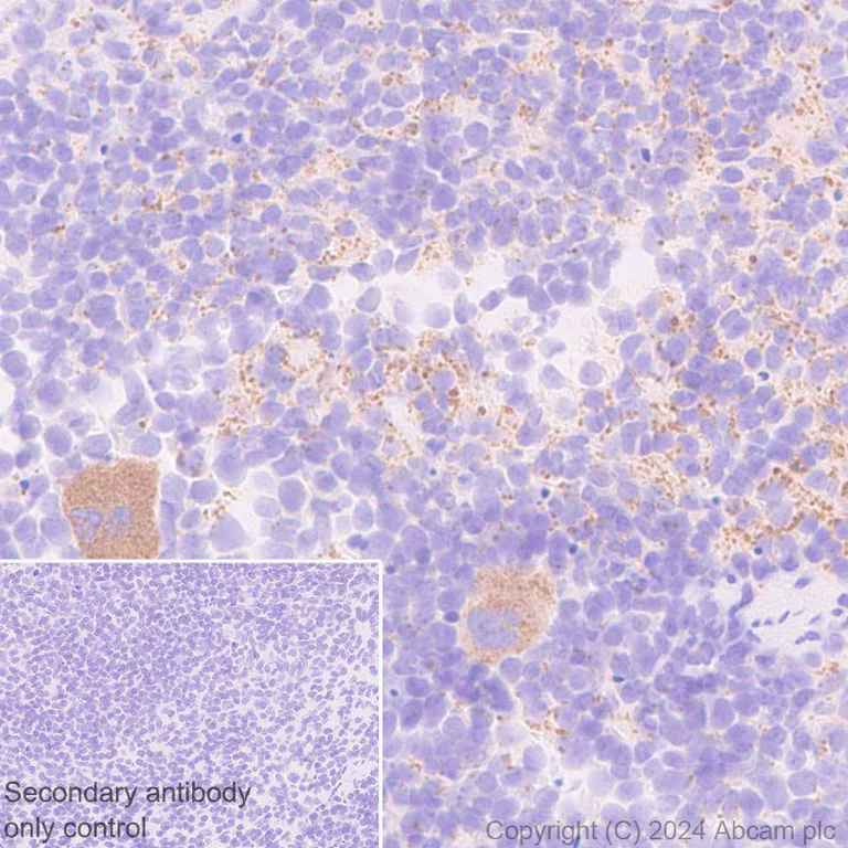 Immunohistochemistry (Formalin/PFA-fixed paraffin-embedded sections) - Anti-Protein S antibody [EPR28196-36] - BSA and Azide free (AB316282)