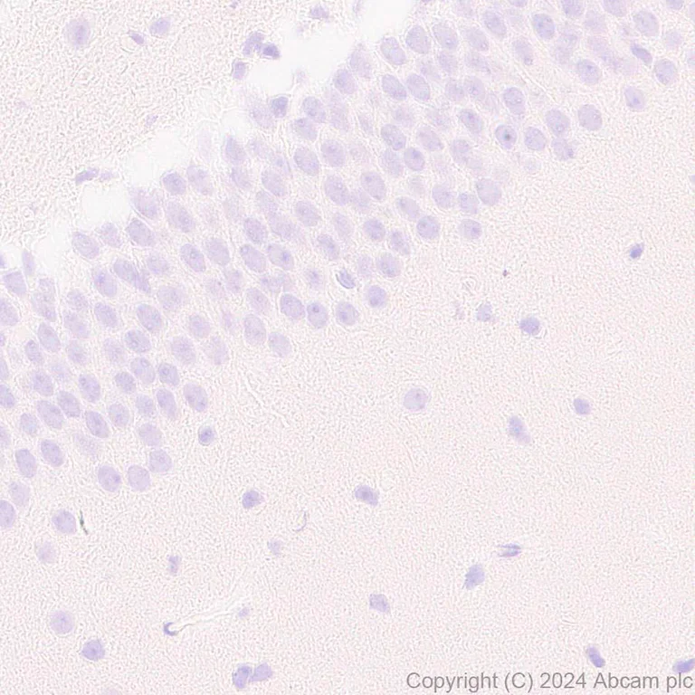 Immunohistochemistry (Formalin/PFA-fixed paraffin-embedded sections) - Anti-Protein S antibody [EPR28196-36] - BSA and Azide free (AB316282)