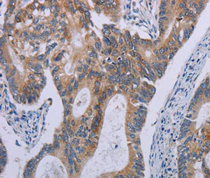 Immunohistochemistry (Formalin/PFA-fixed paraffin-embedded sections) - Anti-Proteinase Activated Receptor 3/PAR-3 antibody (AB200400)