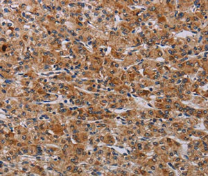 Immunohistochemistry (Formalin/PFA-fixed paraffin-embedded sections) - Anti-Proteinase Activated Receptor 3/PAR-3 antibody (AB200400)