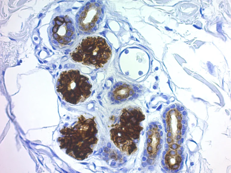 Immunohistochemistry (Formalin/PFA-fixed paraffin-embedded sections) - Proteinase K Antigen Retrieval Solution (AB64220)