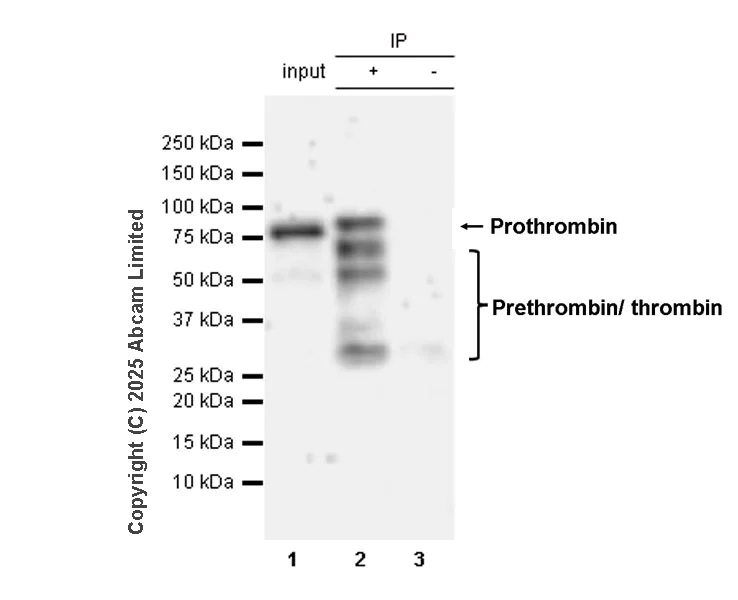 Immunoprecipitation - Anti-Prothrombin antibody [EPR20159] - BSA and Azide free (AB251496)