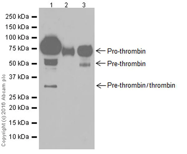 Western blot - Anti-Prothrombin antibody [EPR20159] - BSA and Azide free (AB251496)