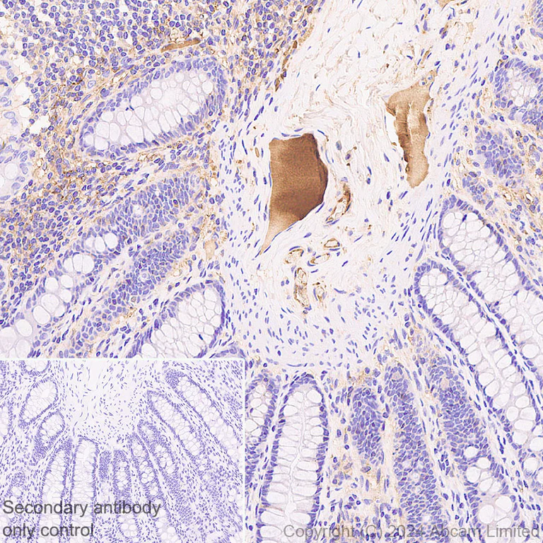 Immunohistochemistry (Formalin/PFA-fixed paraffin-embedded sections) - Anti-Prothrombin antibody [RM1252] (AB322113)