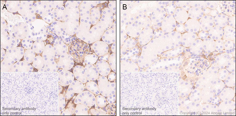 Immunohistochemistry (Formalin/PFA-fixed paraffin-embedded sections) - Anti-Prothrombin antibody [RM1252] (AB322113)