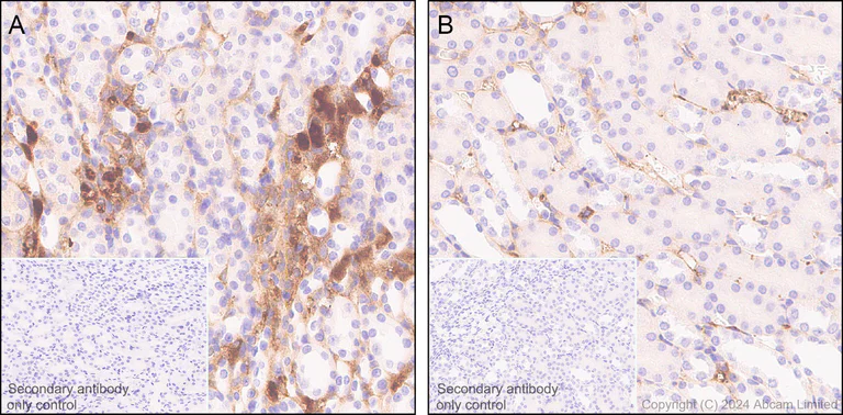 Immunohistochemistry (Formalin/PFA-fixed paraffin-embedded sections) - Anti-Prothrombin antibody [RM1252] (AB322113)