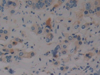 Immunohistochemistry (Formalin/PFA-fixed paraffin-embedded sections) - Anti-Prothrombin fragment 2 antibody (ab233297), expandable thumbnail