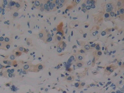 Immunohistochemistry (Formalin/PFA-fixed paraffin-embedded sections) - Anti-Prothrombin fragment 2 antibody (AB233297)