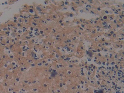 Immunohistochemistry (Formalin/PFA-fixed paraffin-embedded sections) - Anti-Prothrombin fragment 2 antibody (AB233297), expandable thumbnail