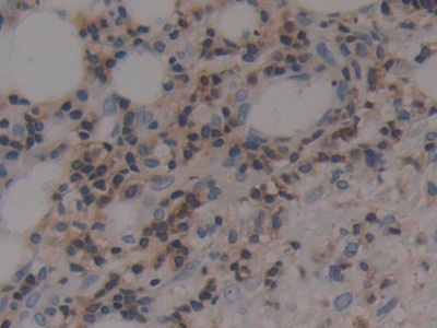 Immunohistochemistry (Formalin/PFA-fixed paraffin-embedded sections) - Anti-Prothrombin fragment 2 antibody (AB233297), expandable thumbnail