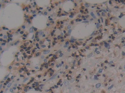 Immunohistochemistry (Formalin/PFA-fixed paraffin-embedded sections) - Anti-Prothrombin fragment 2 antibody (AB233297)