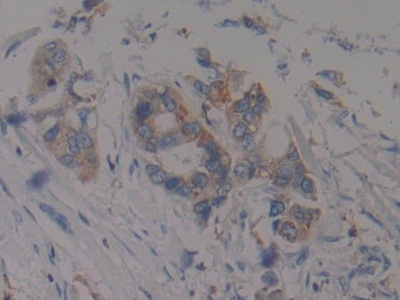 Immunohistochemistry (Formalin/PFA-fixed paraffin-embedded sections) - Anti-Prothrombin fragment 2 antibody (AB233297), expandable thumbnail