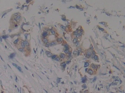 Immunohistochemistry (Formalin/PFA-fixed paraffin-embedded sections) - Anti-Prothrombin fragment 2 antibody (AB233297)