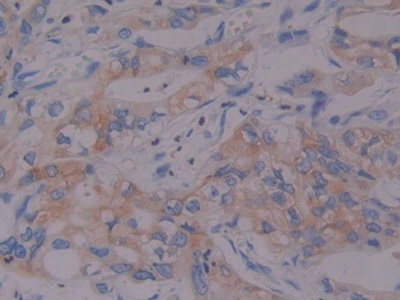 Immunohistochemistry (Formalin/PFA-fixed paraffin-embedded sections) - Anti-Prothrombin fragment 2 antibody (AB233297), expandable thumbnail