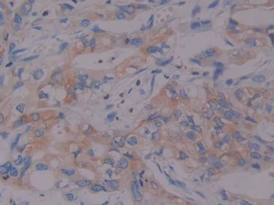 Immunohistochemistry (Formalin/PFA-fixed paraffin-embedded sections) - Anti-Prothrombin fragment 2 antibody (AB233297)