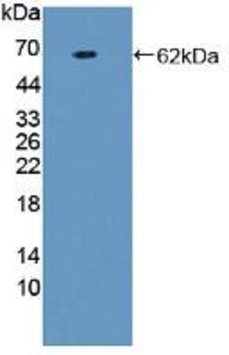 Western blot - Anti-Prothrombin fragment 2 antibody (ab233297), expandable thumbnail