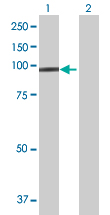 Western blot - Anti-Protocadherin 21 antibody (AB168220)