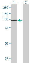 Western blot - Anti-Protocadherin 21 antibody (AB168220)