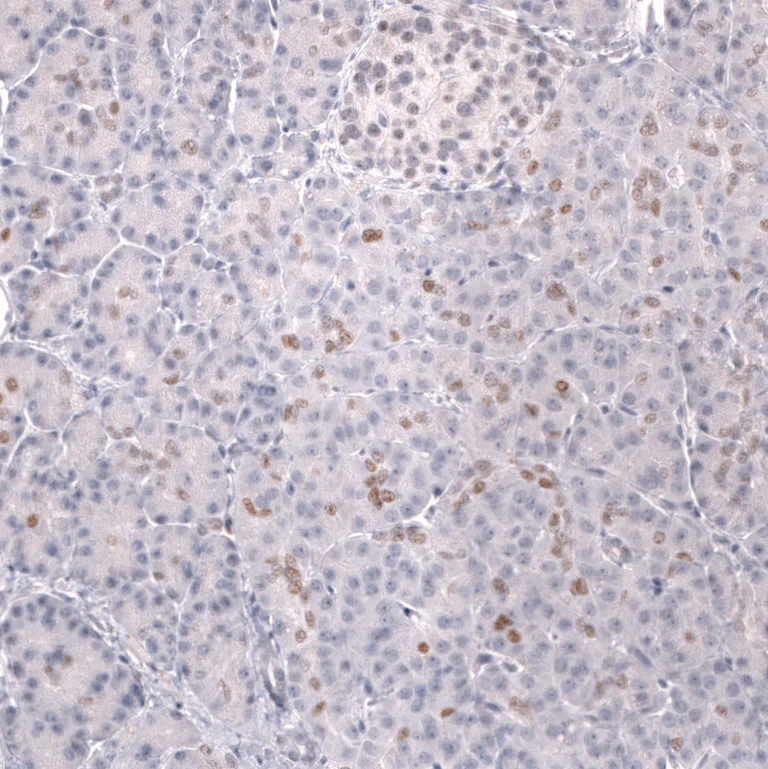 Immunohistochemistry (Formalin/PFA-fixed paraffin-embedded sections) - Anti-PROX1 Antibody [CL13472] (AB327147)