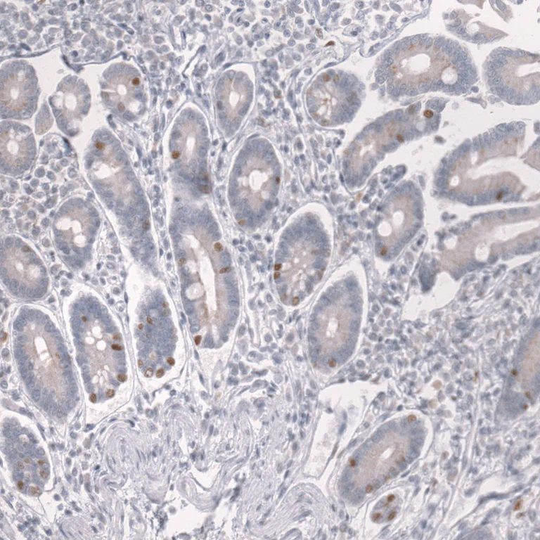 Immunohistochemistry (Formalin/PFA-fixed paraffin-embedded sections) - Anti-PROX1 Antibody [CL13472] (AB327147)