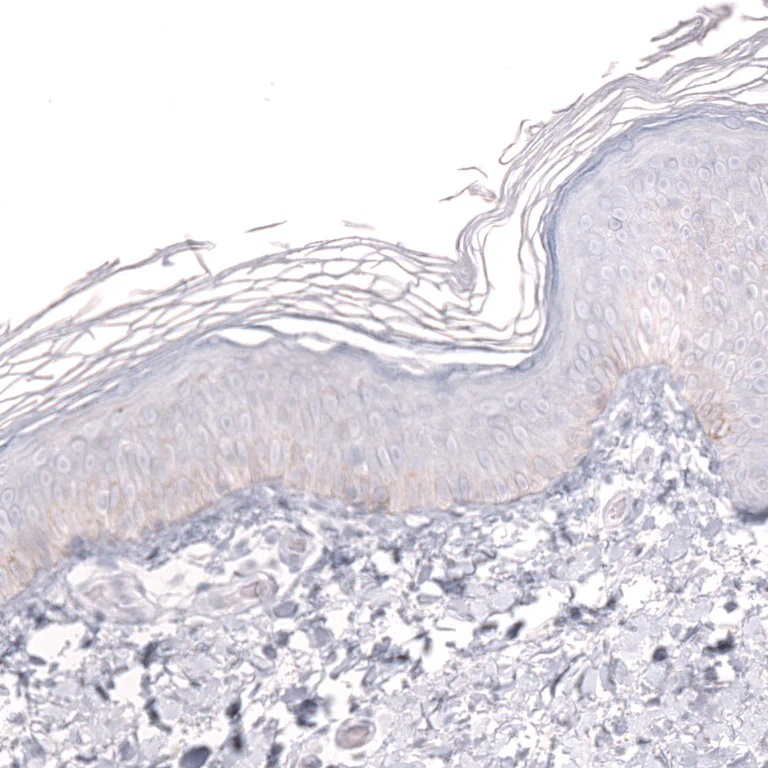 Immunohistochemistry (Formalin/PFA-fixed paraffin-embedded sections) - Anti-PROX1 Antibody [CL13472] (AB327147)