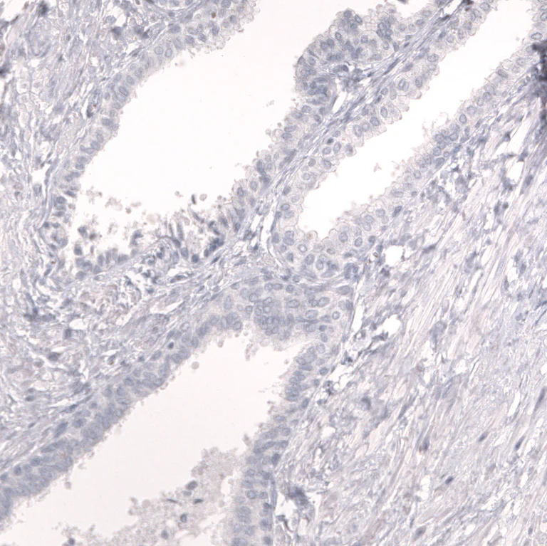 Immunohistochemistry (Formalin/PFA-fixed paraffin-embedded sections) - Anti-PROX1 Antibody [CL13472] (AB327147)
