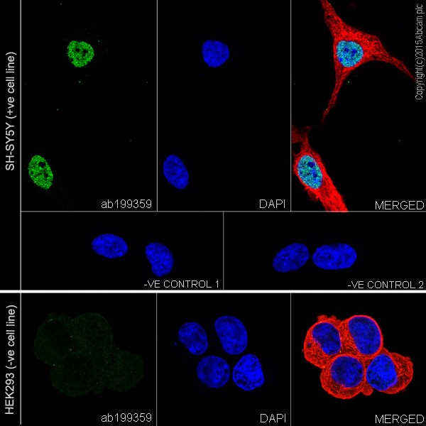 Immunocytochemistry/ Immunofluorescence - Anti-PROX1 antibody [EPR19273] (AB199359)