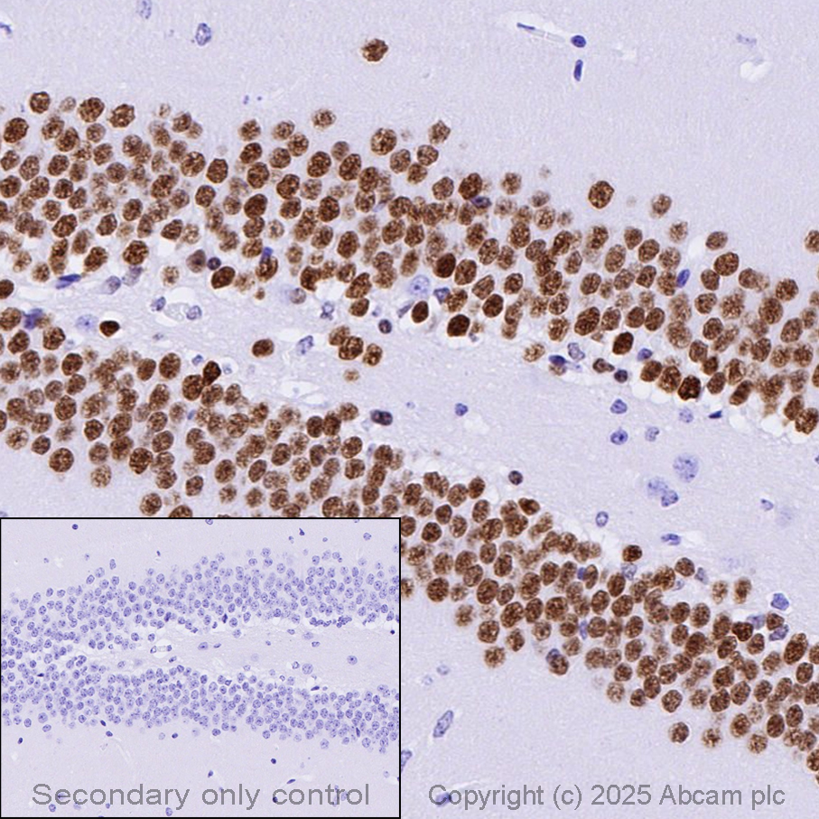 Anti-PROX1 antibody [EPR19273]