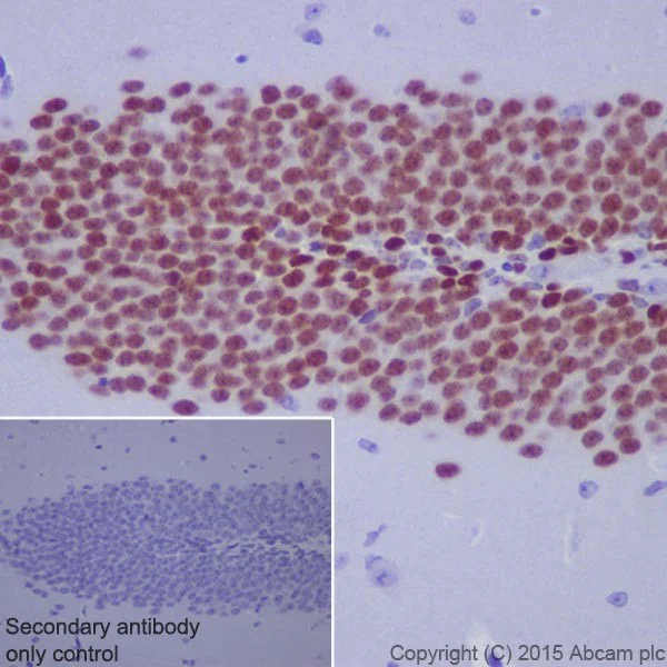 Immunohistochemistry (Formalin/PFA-fixed paraffin-embedded sections) - Anti-PROX1 antibody [EPR19273] (AB199359)