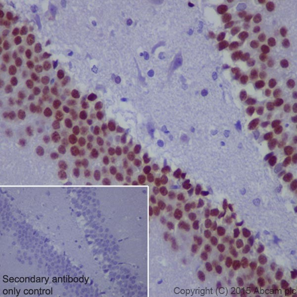 Immunohistochemistry (Formalin/PFA-fixed paraffin-embedded sections) - Anti-PROX1 antibody [EPR19273] - BSA and Azide free (AB236026), expandable thumbnail