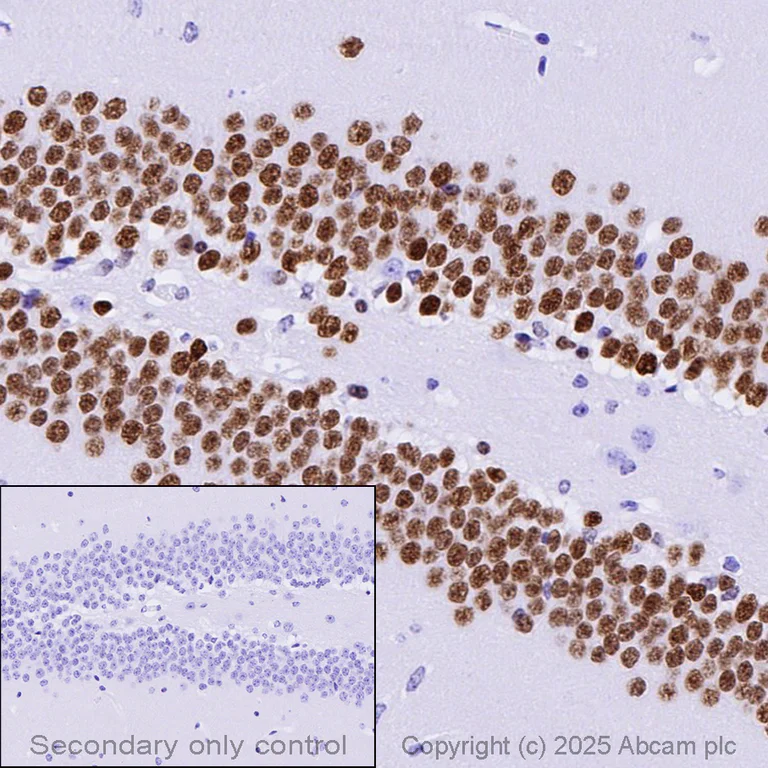 Immunohistochemistry (Formalin/PFA-fixed paraffin-embedded sections) - Anti-PROX1 antibody [EPR19273] - BSA and Azide free (AB236026)