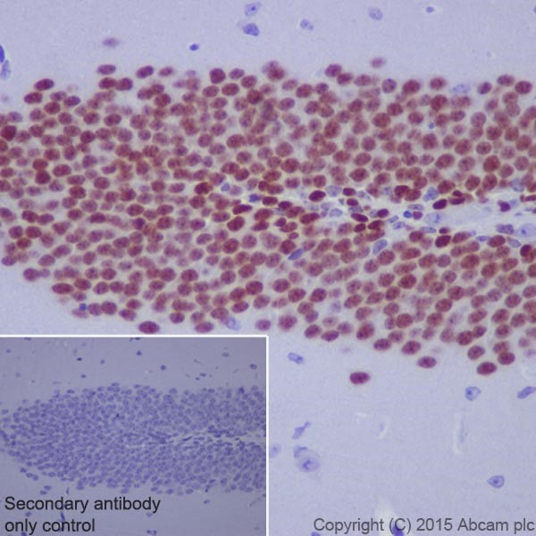 Immunohistochemistry (Formalin/PFA-fixed paraffin-embedded sections) - Anti-PROX1 antibody [EPR19273] - BSA and Azide free (AB236026), expandable thumbnail
