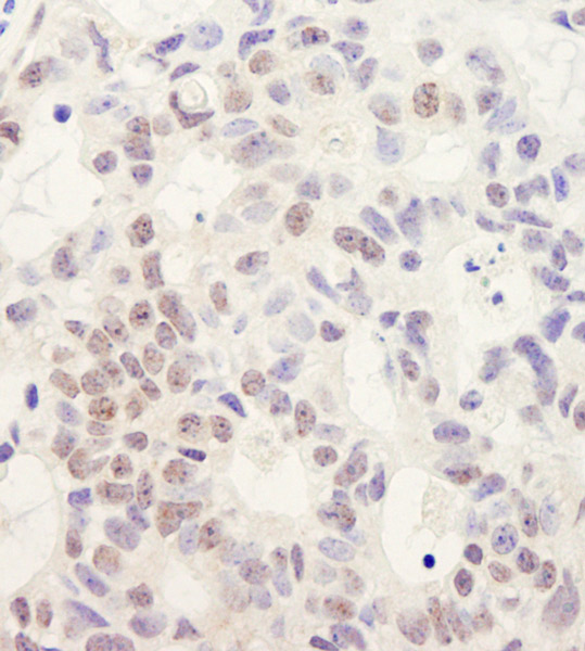 Immunohistochemistry (Formalin/PFA-fixed paraffin-embedded sections) - Anti-PRP16 antibody (AB70781), expandable thumbnail