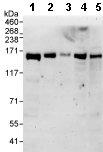 Western blot - Anti-PRP16 antibody (AB70781), expandable thumbnail